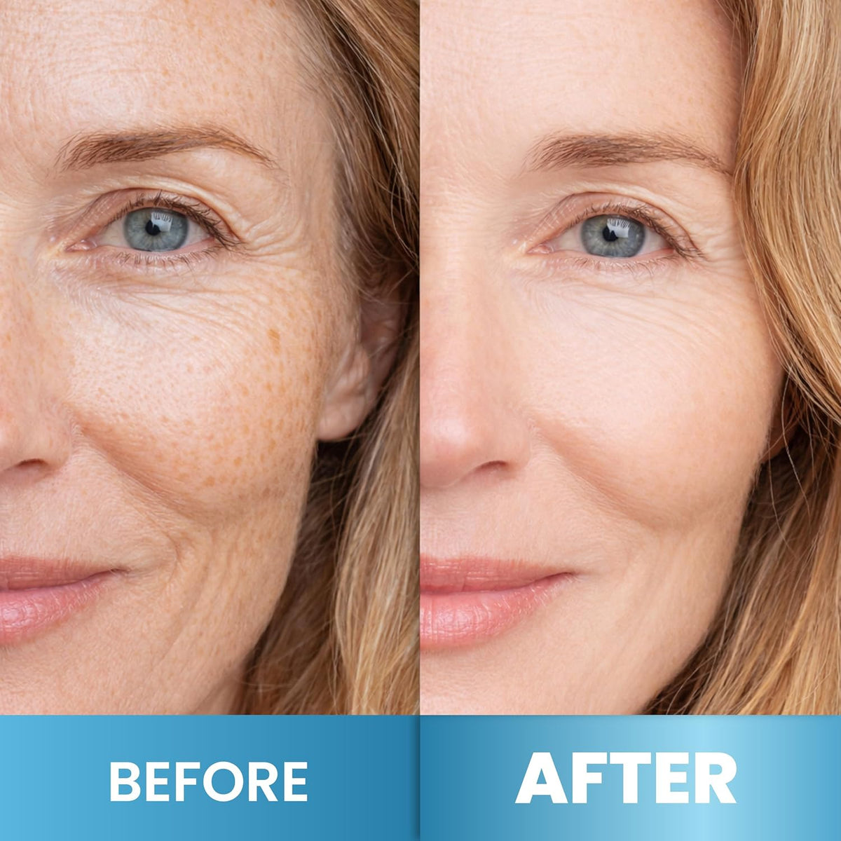 Arvesa Retinol Cream Ansigtscreme Fugtighedscreme 50g RCQ-1
